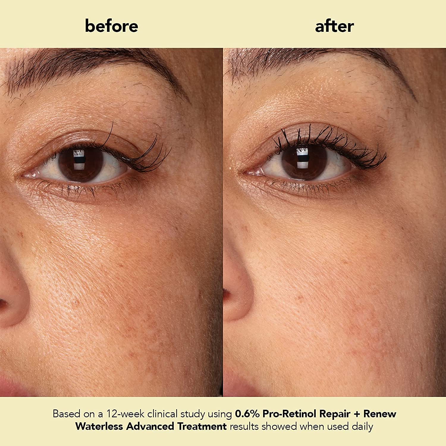 boscia Pro-Retinol Reparación + Renew Tratamiento Avanzado Sin Agua. Suero Libre de Crueldad. Anti-Arrugas, Antienvejecimiento. Vitamina C para Hiperpigmentación 1 fl oz