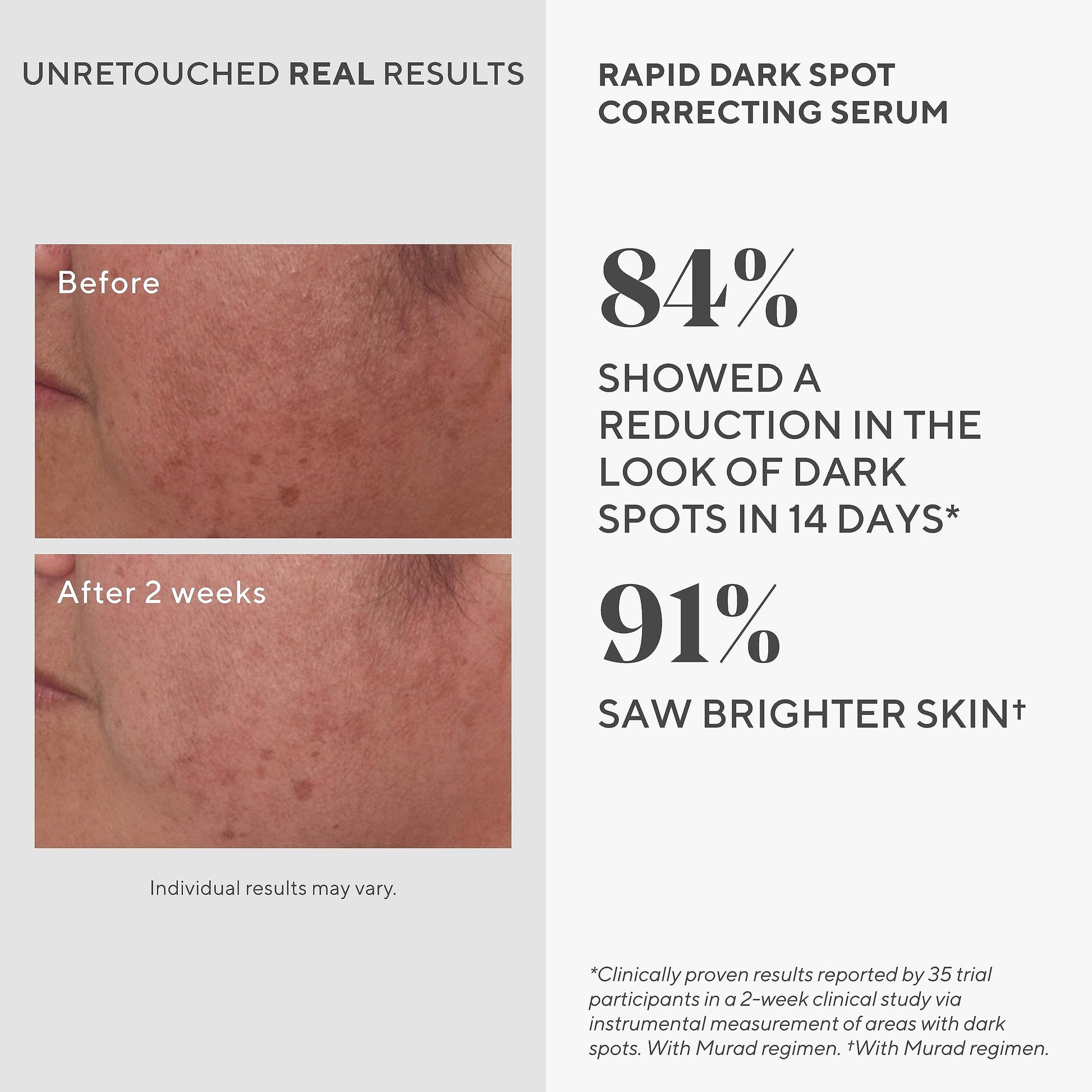 Murad - Rapid Dark Spot Correcting Serum - 30ml, 15348, 03 kilograms, 30 mililitro, 1