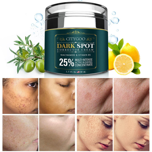 CITYGOO - Eliminador de manchas oscuras para el rostro y cuerpo: crema correctora de manchas oscuras con ingredientes naturales y efectivos para una piel radiante