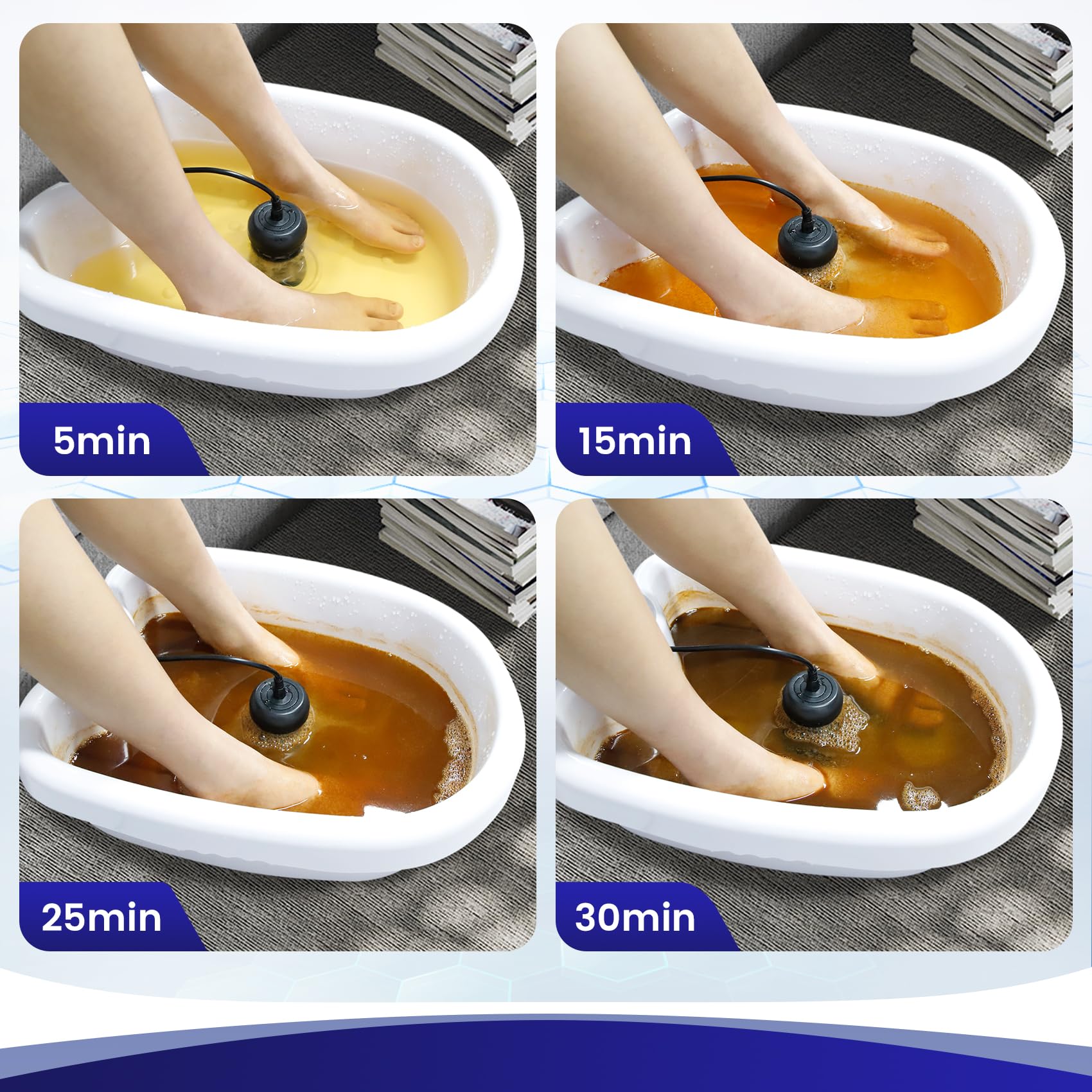 Máquina de pie de desintoxicación de iones iónicos, máquina de limpieza de spa de pie acuático con reproductor MP3