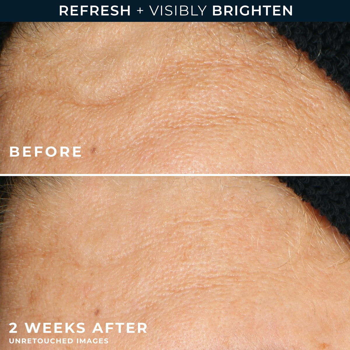RoC Multi Correxion Revive + Limpiador facial en gel brillante con vitamina C y ácido glicólico, cuidado de la piel sin parabenos ni sulfatos, 6 onzas