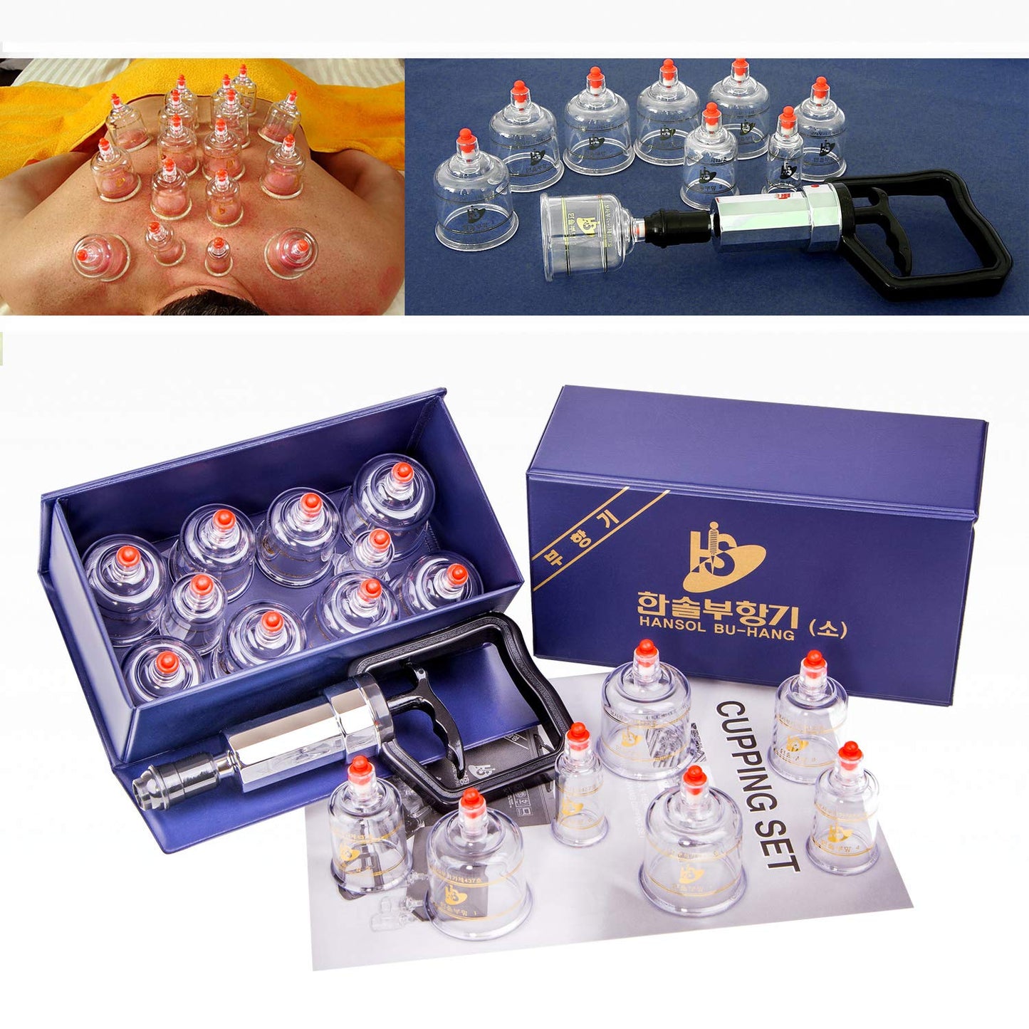 Hansol Professional Cupping Therapy Equipment Set with pumping handle 10 Cups & English Manual (Made in Korea) by Hansol Medical Equipment