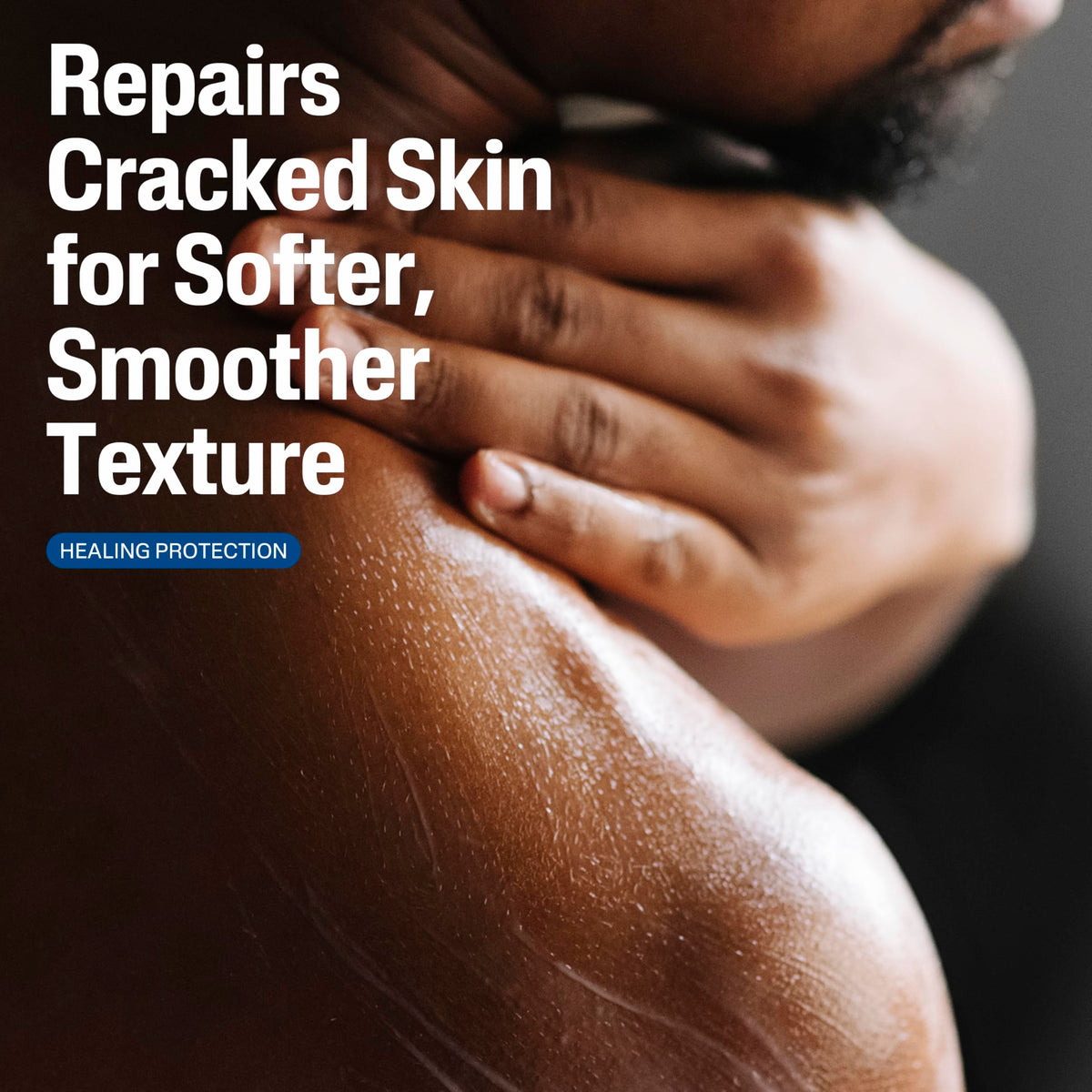 Cetaphil Cracked Skin Repair Lotion 473 ml