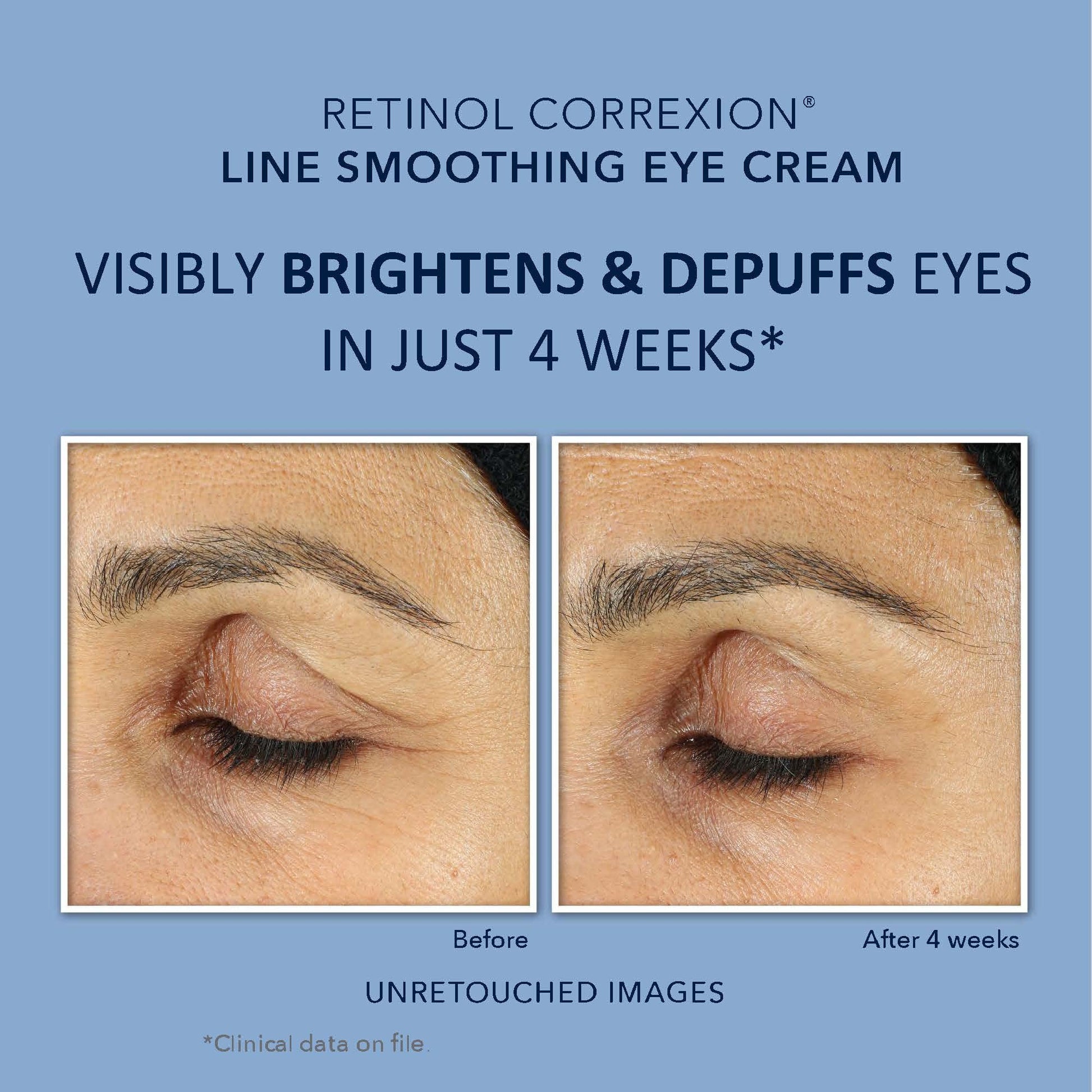 RoC Retinol Correxion Deep Wrinkle Repair Pack