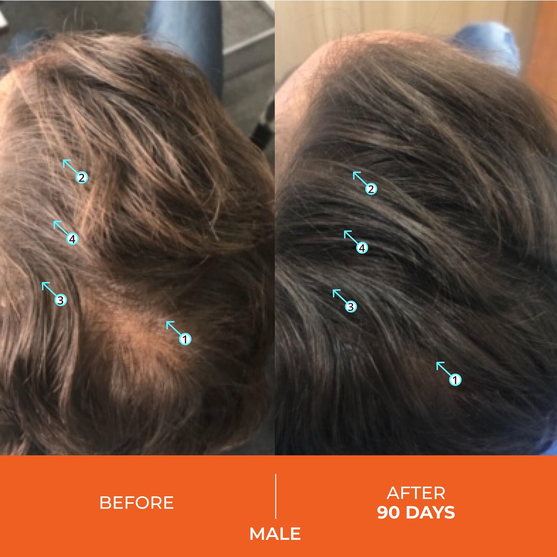 DS Laboratories | Revita® Shampoo para la Densidad Capilar