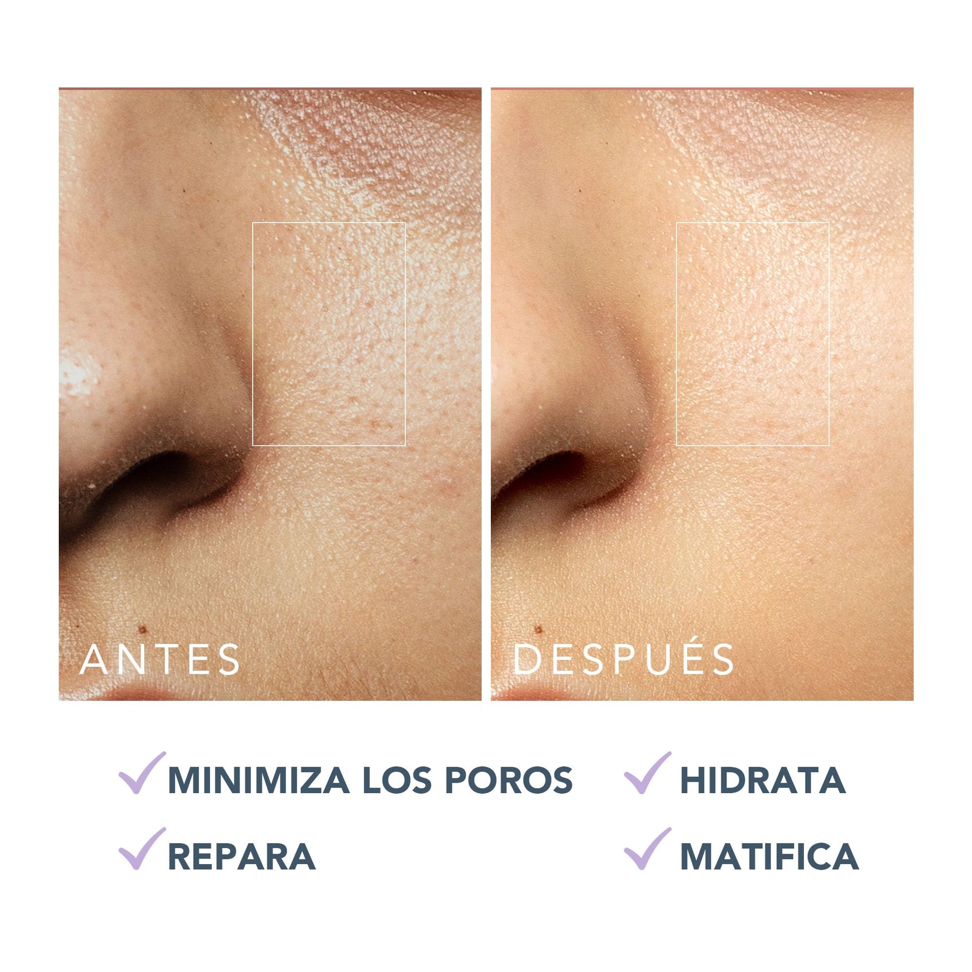 FOREO KIWI Regulador de sebo hidratante y matificante - Cuidado tras herramienta de microdermoabrasión y extractor de puntos negros - Piel grasa con acné - Probado dermatológicamente - Vegano, 40 ml