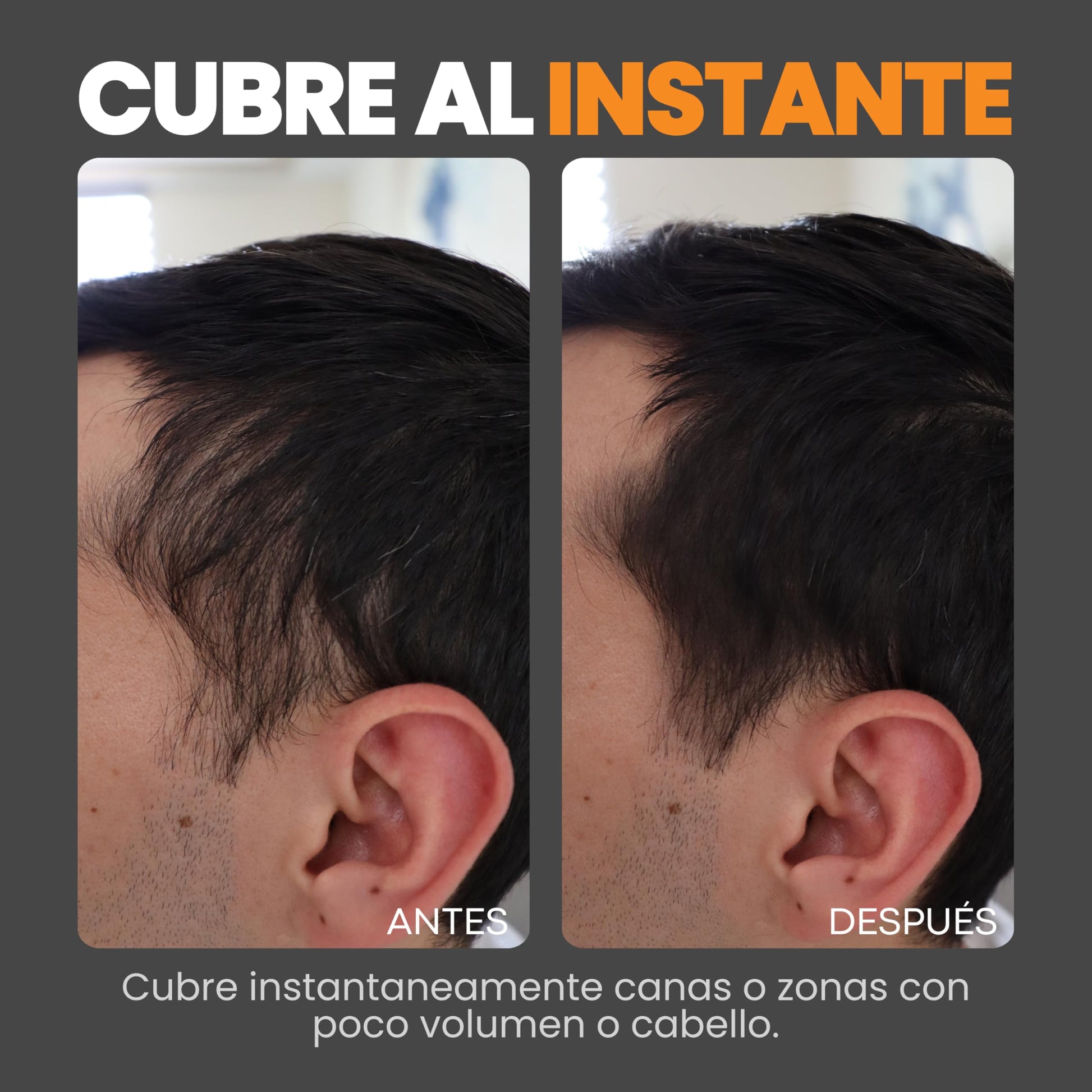 Fibras Capilares, GRIS, Solución para la Calvicie, Caida de Cabello, Alopecia o falta de Volumen, Sin aplicador. 27.5 gramos. Fibras de Construcción de Cabello. Ideal para el Cabello Delgado. Fibras de Algodón 100% Natural. Voluminizador y texturizador de
