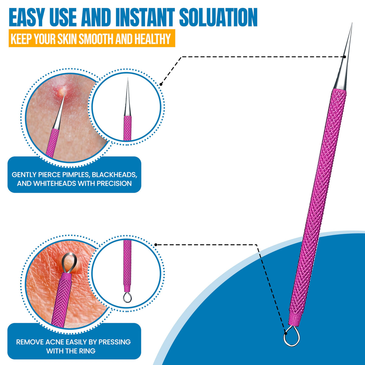 EFAH Care Extractor de espinillas de acero inoxidable para tratamiento del acné, manchas quirúrgicas, eliminador de puntos negros, perfecto para la cara y la nariz, fácil de limpiar, color rosa