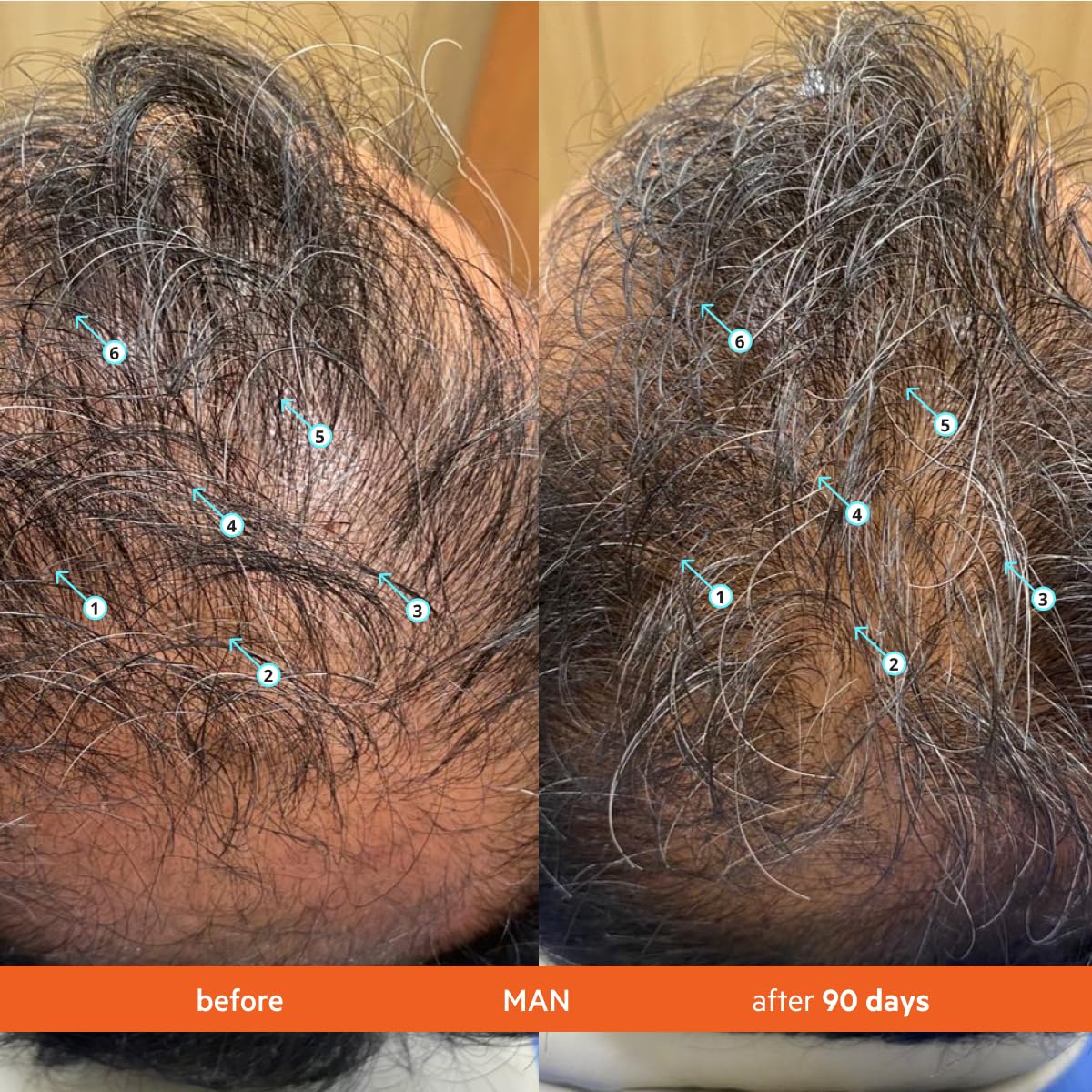 Ds Laboratories | Revita® Shampoo para la Densidad Capilar.