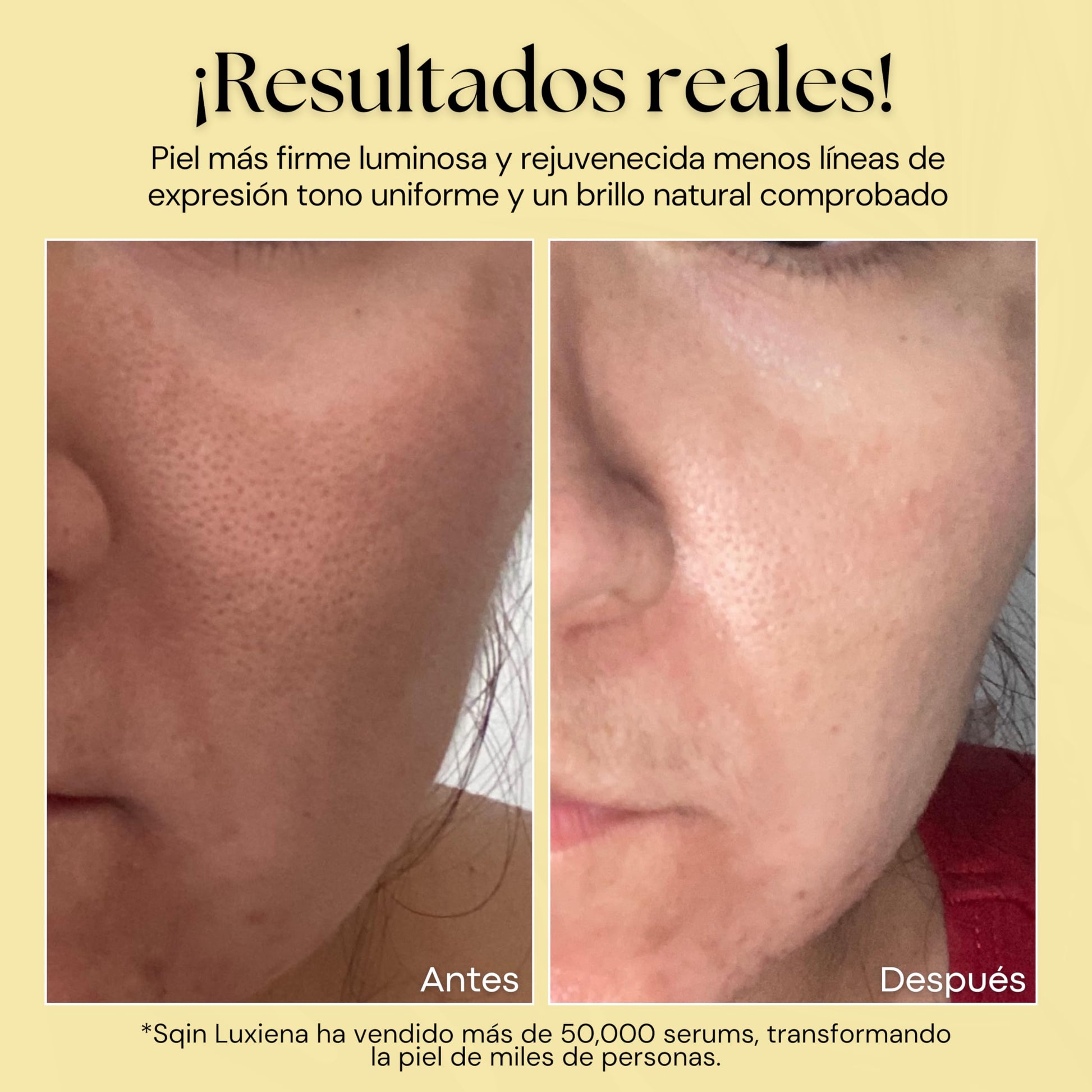 Sqin Luxiena Kit Skin Care 3 Serums Faciales Día y Noche: Vitamina C 2%, Retinol 0.15% y Baba de Caracol 96% . Hidratante Facial, Suero Facial Anti manchas con Vitamina C + E, Serum Profesional Antiarrugas + Antioxidante. Set Antienvejecimiento.