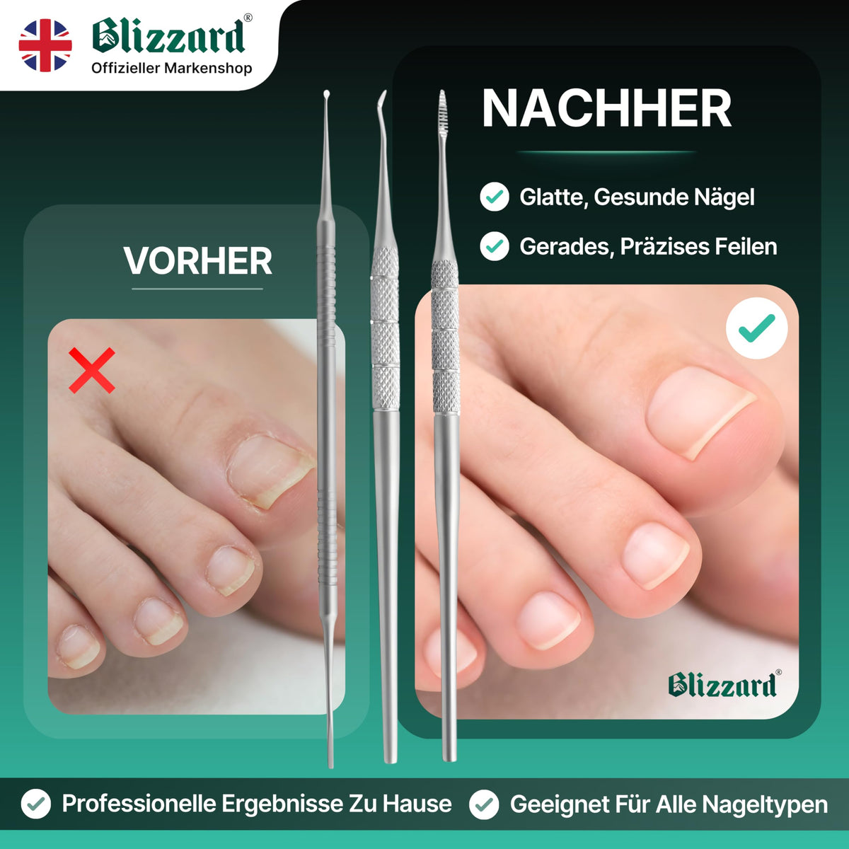 Blizzard Kit Pedicura Profesional 3 Piezas - Herramientas para Uñas Encarnadas y Delicadas - Utensilios de Acero Inoxidable Podología Lima Metálica Sonda Elevador Limpiador Cuidado de Pies Premium