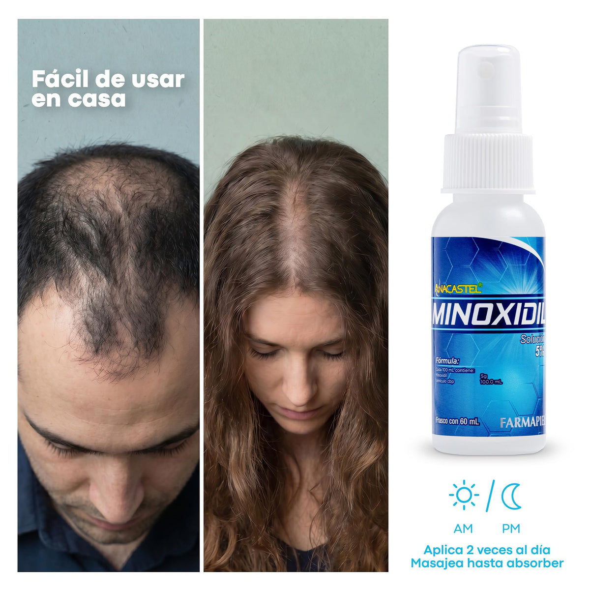 Spray Anticaída Anacastel Minoxidil 5% 60 ml