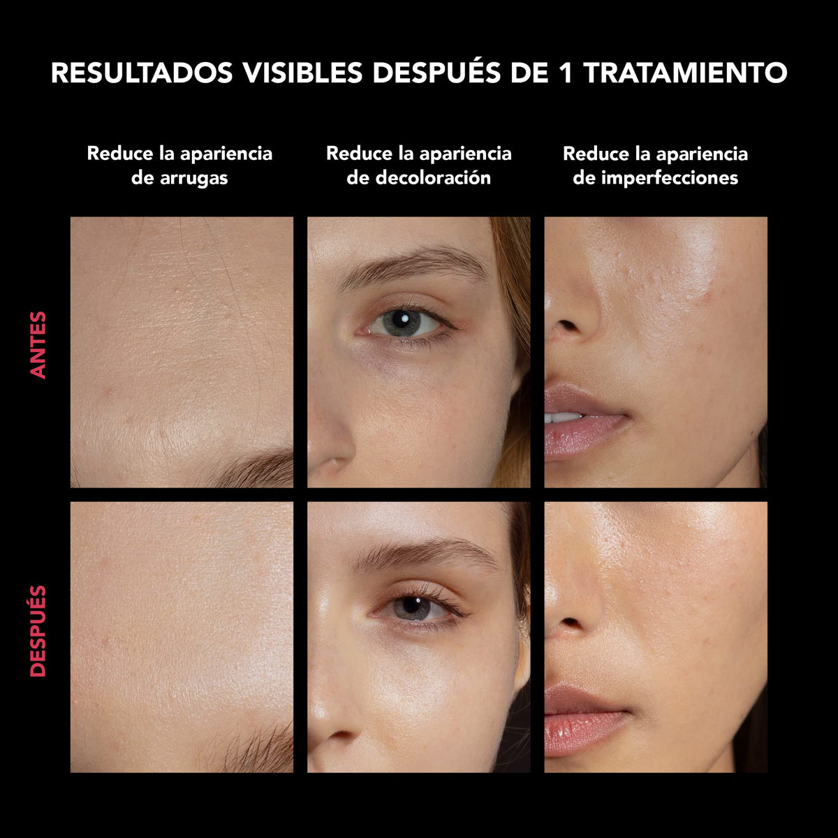 FAQ 202 Máscara facial LED inalámbrica con estuche de viaje - Cuidado antiedad con 8 ajustes - 600 puntos de luz para el tratamiento dirigido y el cuidado facial - Pack de viaje, ligero y duradero