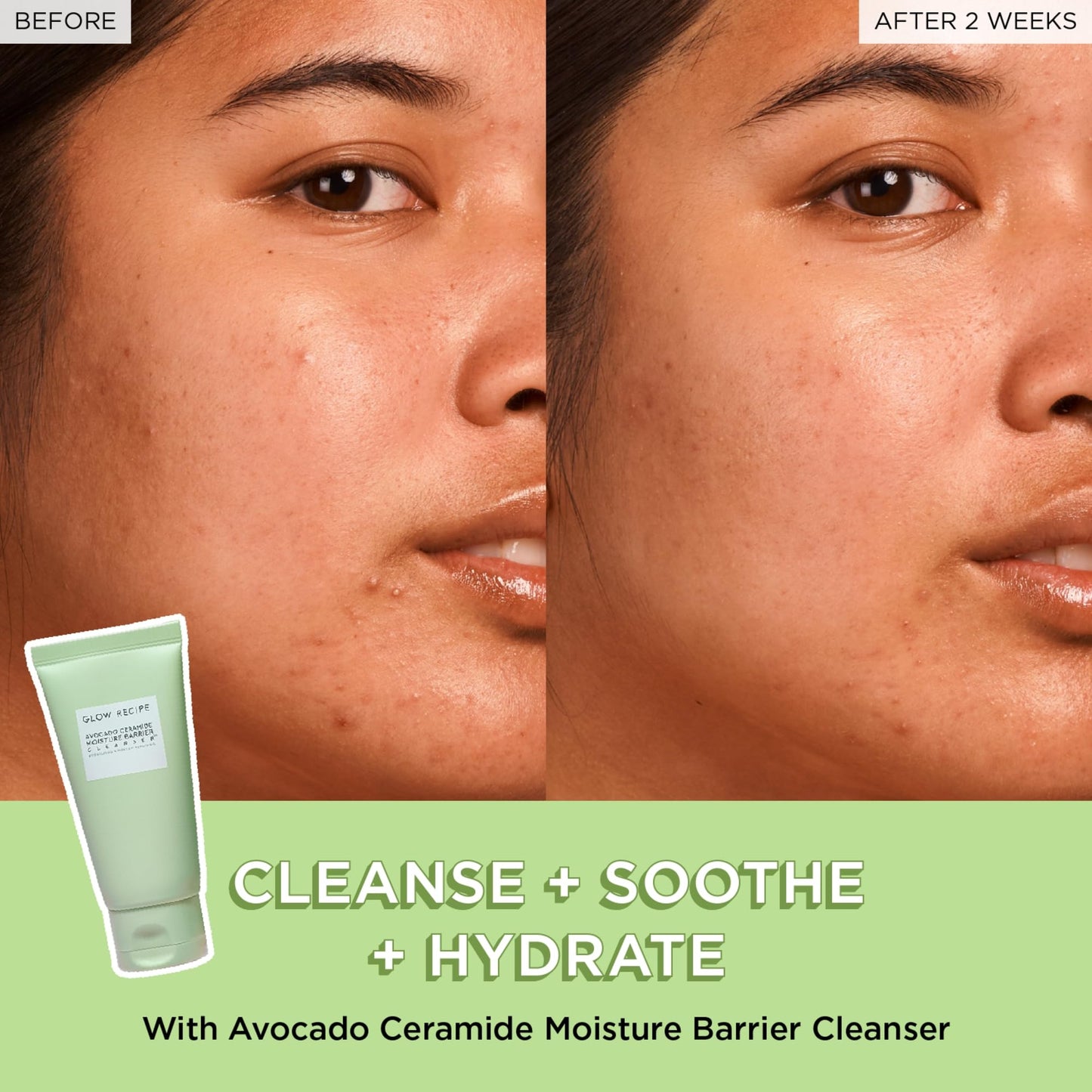 Glow Recipe Avocado Cleanser - Limpiador facial con barrera de humedad y ceramida de aguacate, limpiador facial hidratante para piel seca, removedor de maquillaje diario y lavado facial suave con aceite de aguacate para reparación de barreras cutáneas (5.