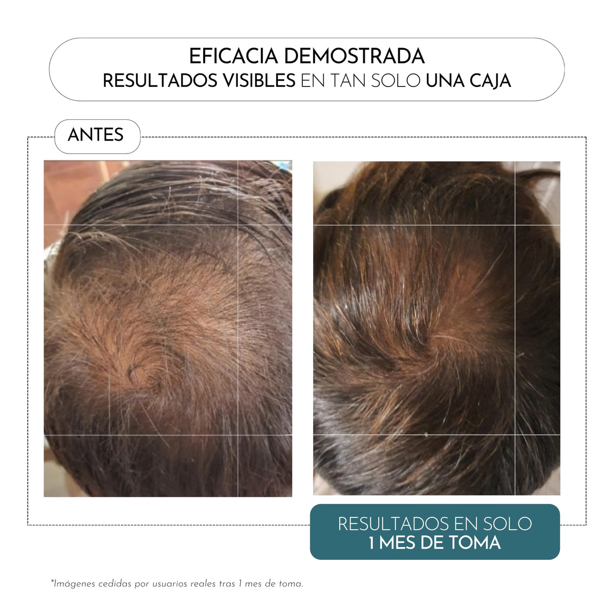 Cápsulas Luxmetique Hair Formula 60 Cápsulas