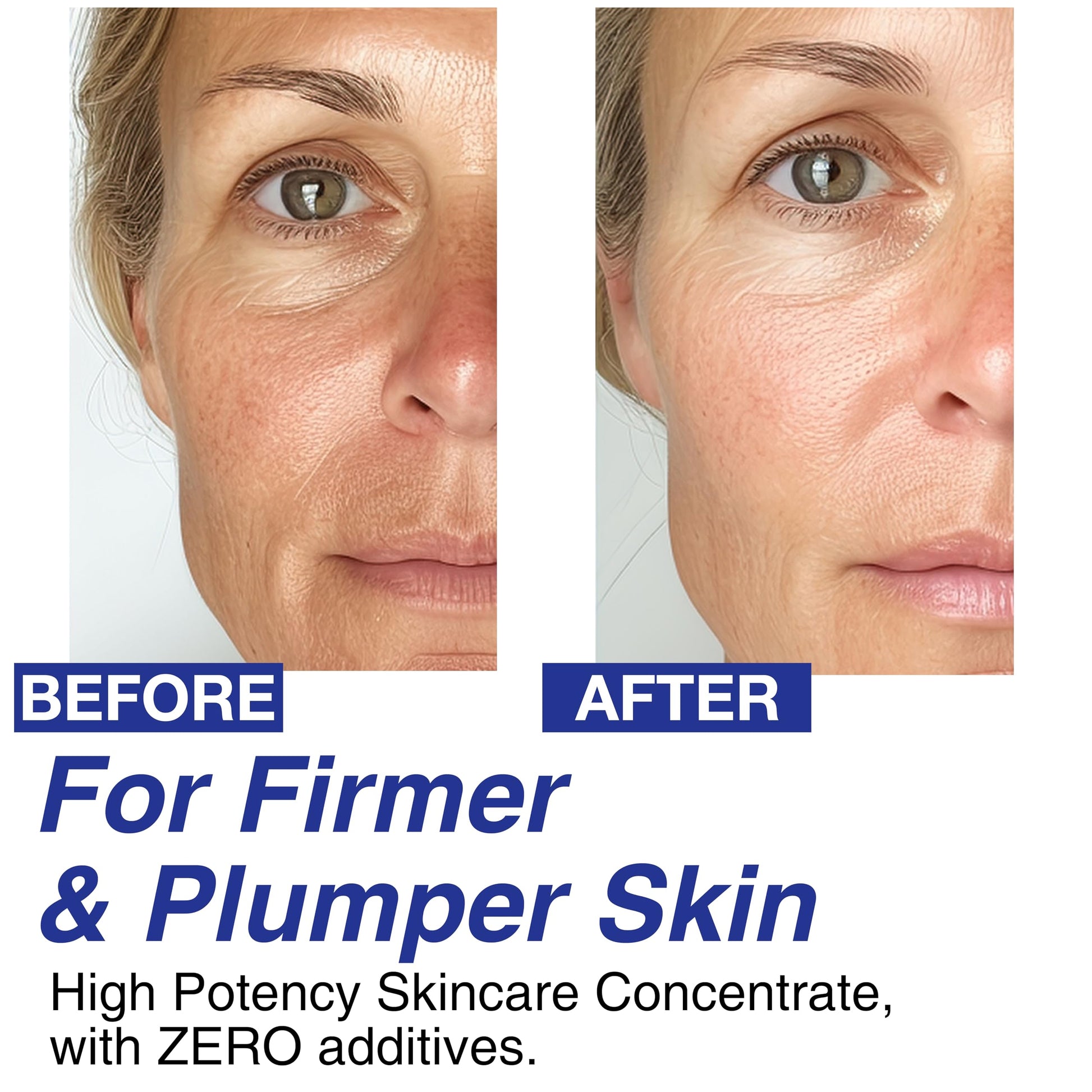 Suero CELDYQUE Volufiline Reafirmante Concentrado