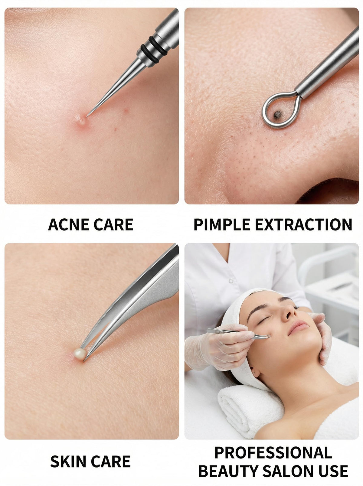 LUQINTH LuQinth, removedor facial de puntos negros de aleación con agujas de doble punta y pinzas de acero para eliminar puntos negros, espinillas y milia.