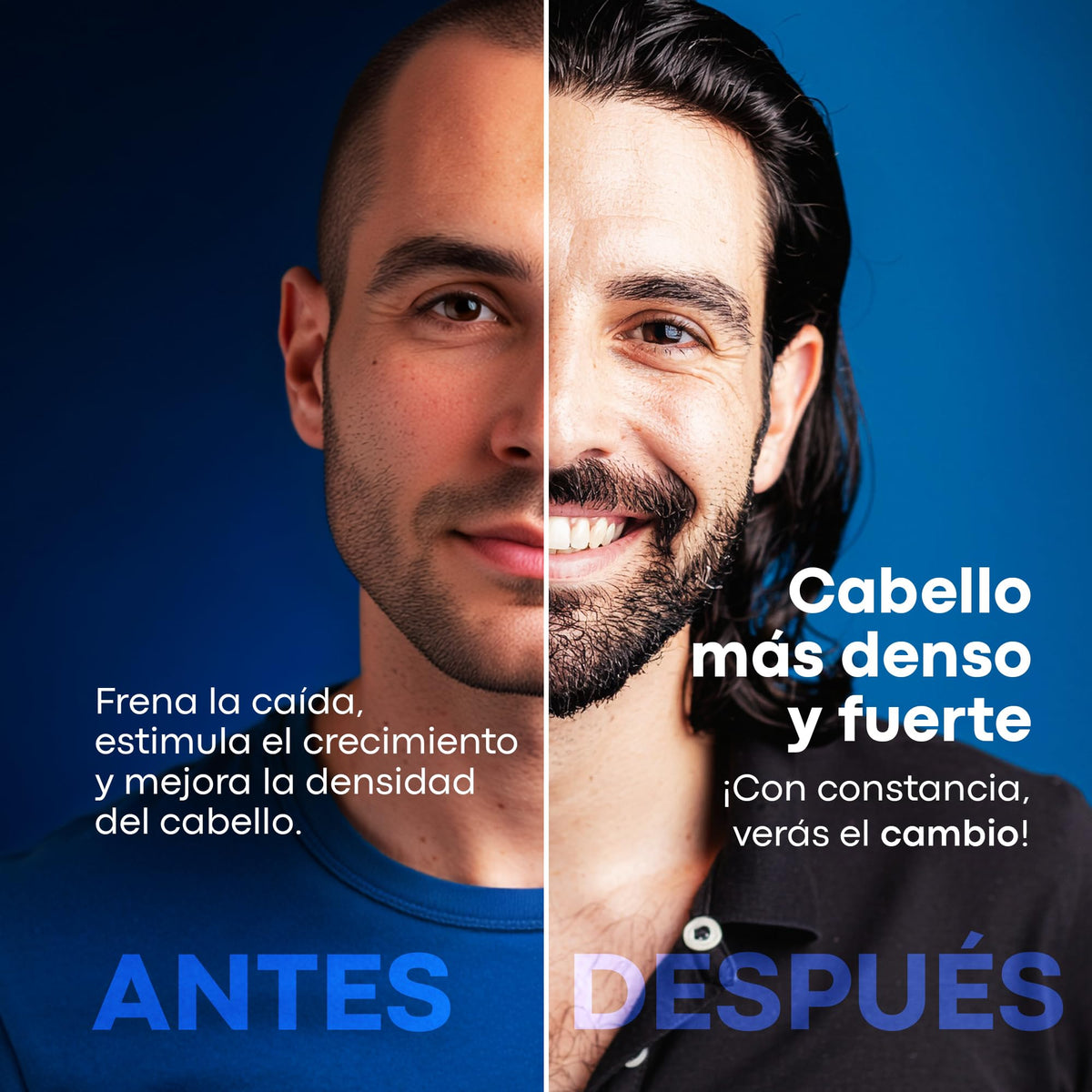 Kit Anticaída Anacastel Minoxidil 5% + Shampoo