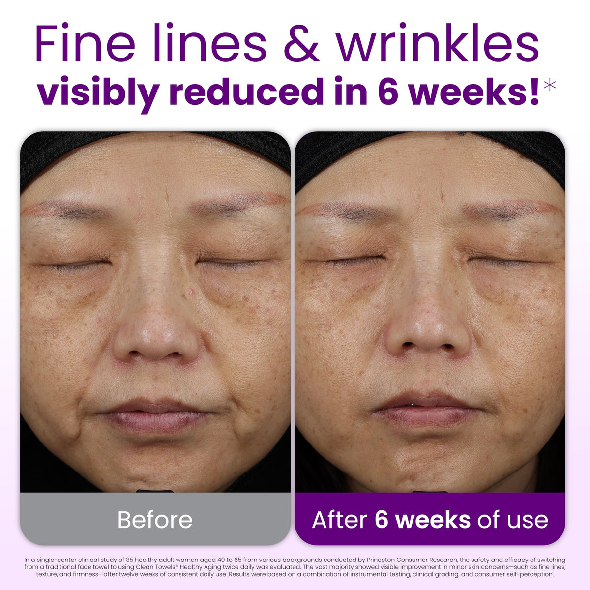 CLEAN SKIN CLUB Toallas Faciales Desechables Healthy Aging Clean Towels Xl, Suavizan Líneas De Expresión, Arrugas Y Textura En 6 Semanas, Tratadas Para Mayor Suavidad, Desmaquillantes Antiedad, Paquet