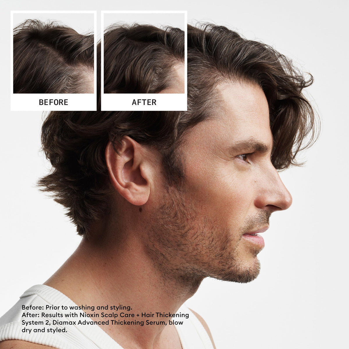 Nioxin Cleanser Shampoo System 2 for Fine Hair with Progressed Thinning, 33.8 Ounce