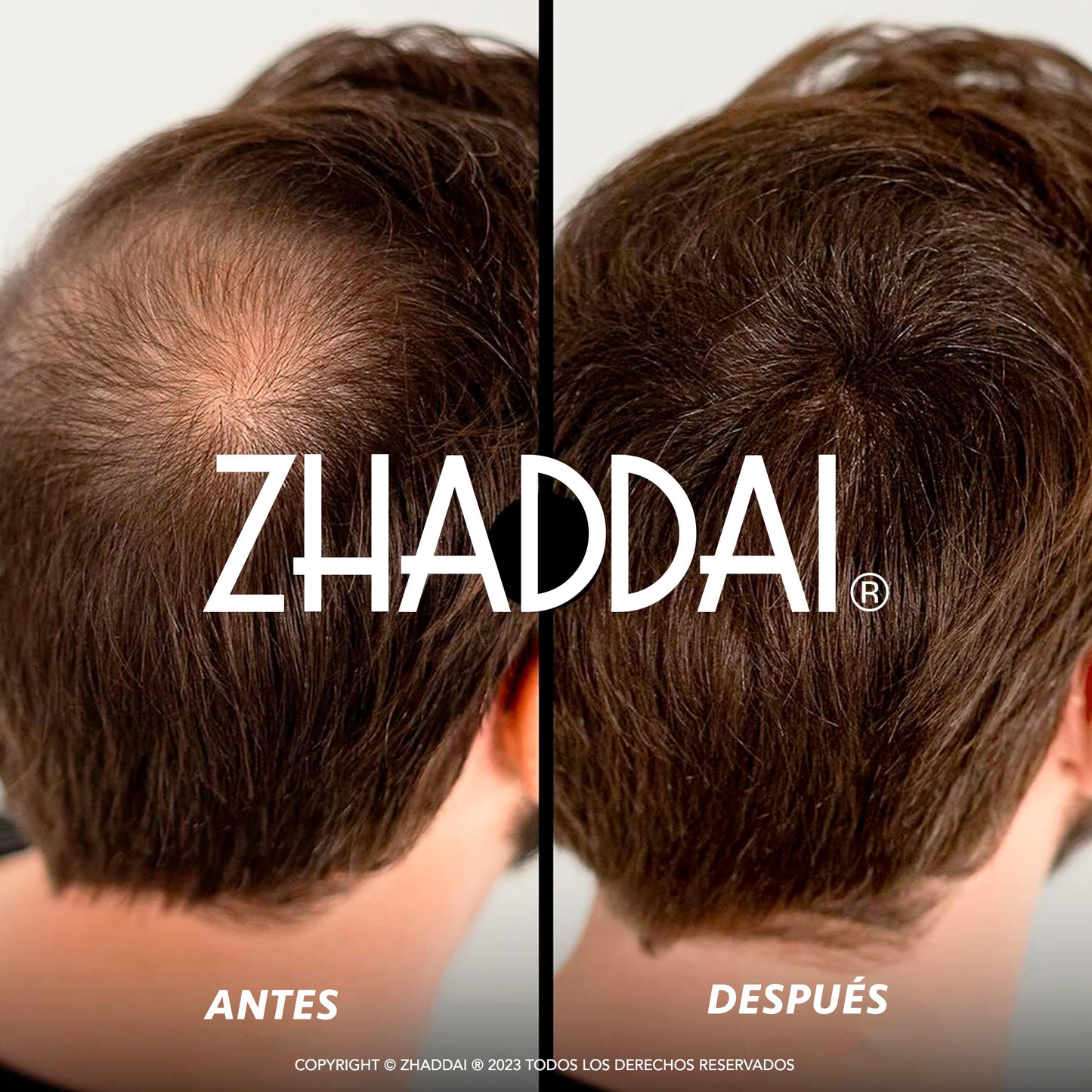 Fibras Capilares ZHADDAI® - 100% Natural. Cubre calvicie, disimula alopecia y densifica cabello. Aporta volumen y textura. ¡Voluminizador Instantáneo!